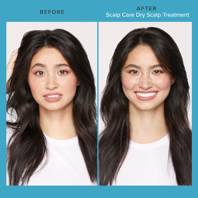 Living Proof Dry Scalp Treatment