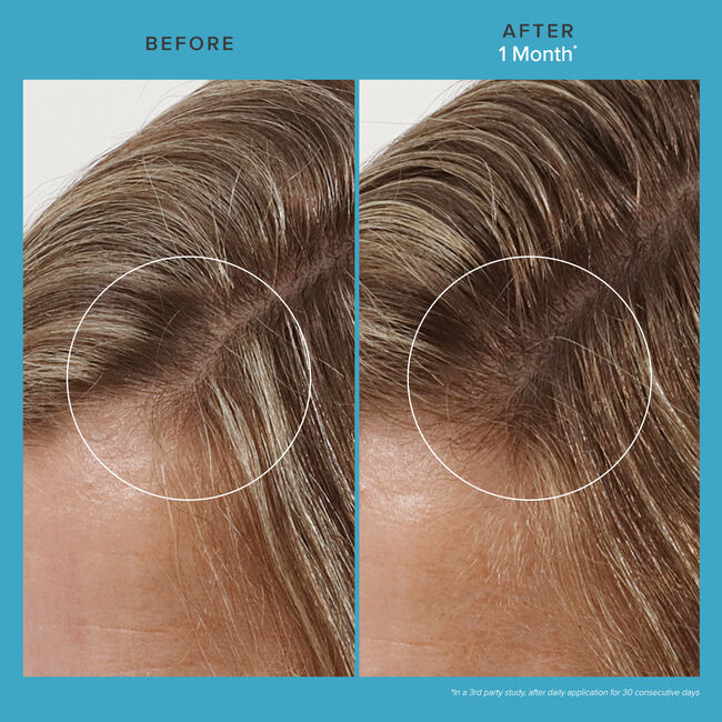 Living Proof Scalp Care Revitalizing Treatment