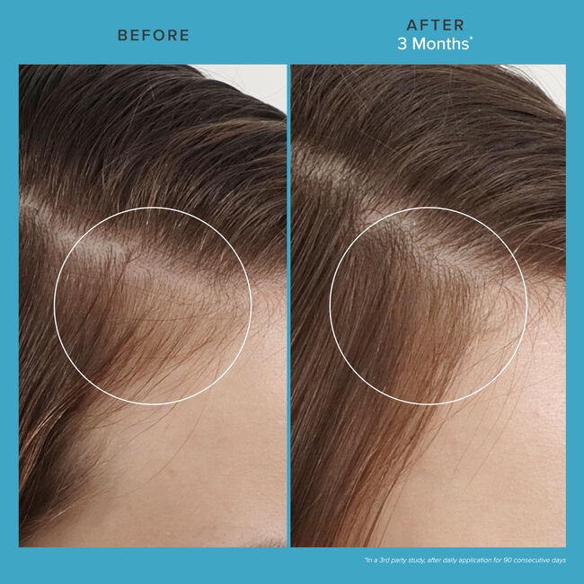 Living Proof Scalp Care Revitalizing Treatment